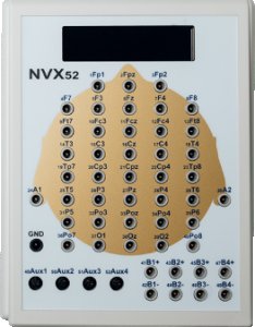 NVX 52